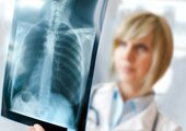 lung transplant